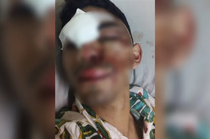 Golpean Brutalmente A Un Joven A La Salida De Un Boliche En El Interior