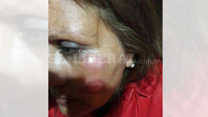 Antildeatuya- recibioacute una brutal golpiza durante asalto