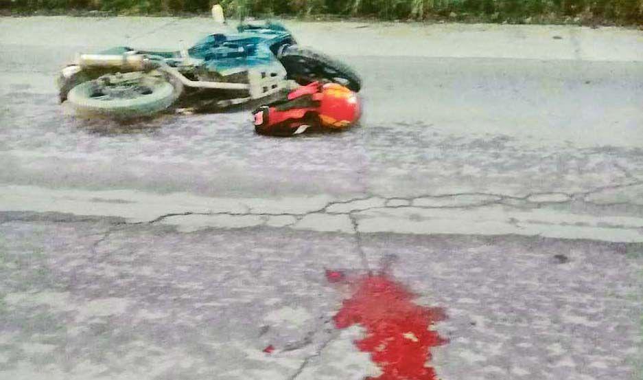 Motociclista sufrioacute severas lesiones en su cabeza tras colisionar con un caballo