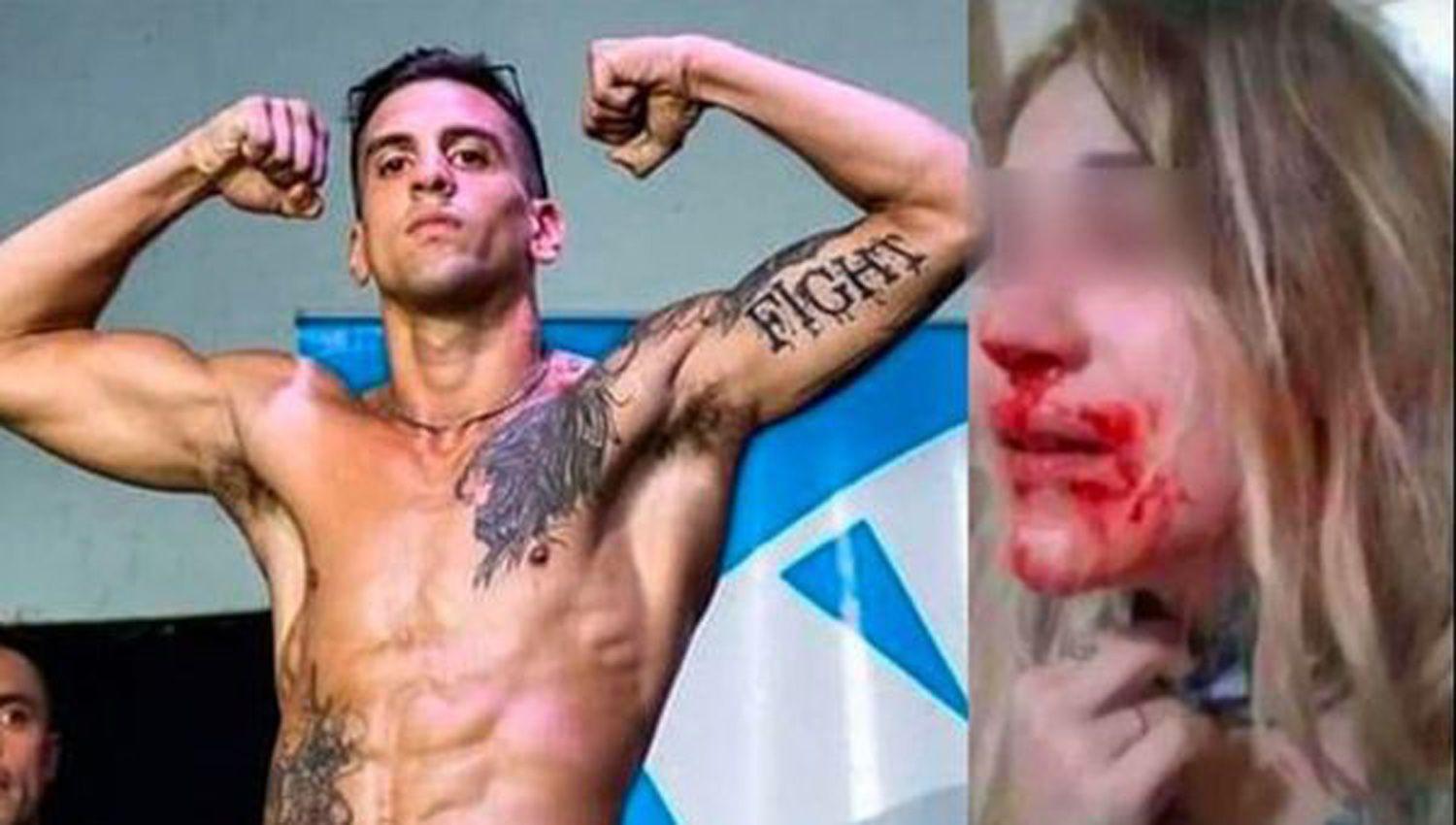 Duro reveacutes judicial para el luchador de MMA que desfiguroacute a golpes a su novia que estaacute cursando un embarazo