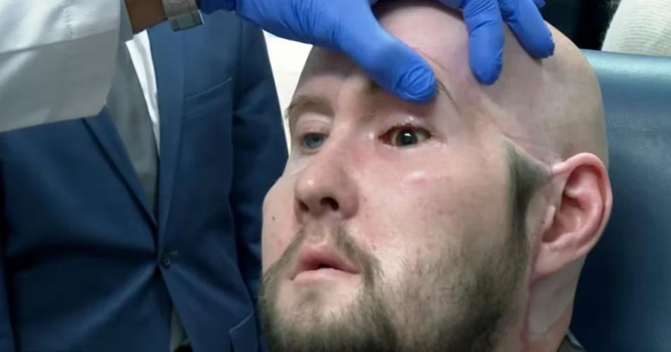 Un hombre recibioacute con eacutexito el primer trasplante de ojo completo en el mundo