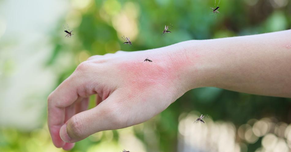 iquestPicadura de mosquito de Dengue o Encefalitis Equina Coacutemo diferenciarlas