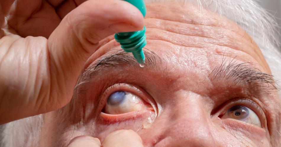 Presioacuten ocular- todo lo que debes saber para evitar el glaucoma a partir de los 40