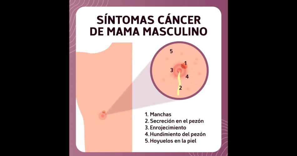 Caacutencer de mama el menos pensado en los hombres