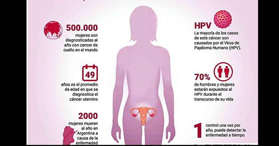 Piden tomar conciencia de la prevencioacuten del caacutencer de uacutetero