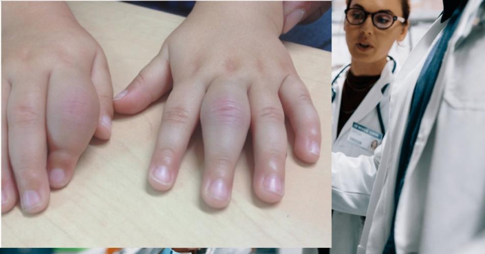 Advierten sobre los cuidados que deben tener los nintildeos con artritis en los diacuteas de intenso friacuteo