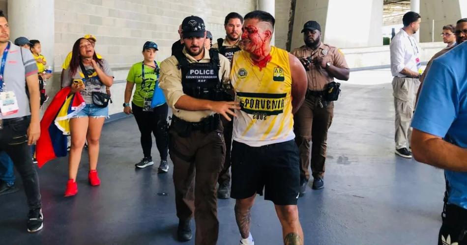 VIDEO  Violencia sangre y arrestos en la final de la Copa Ameacuterica