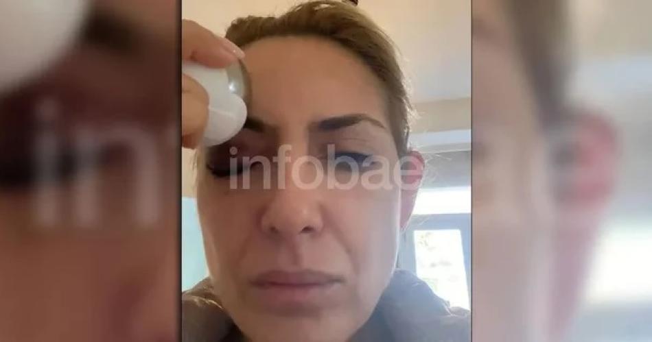 Fabiola Yantildeez mostroacute nuevas imaacutegenes de los golpes que sufrioacute de parte de Alberto Fernaacutendez