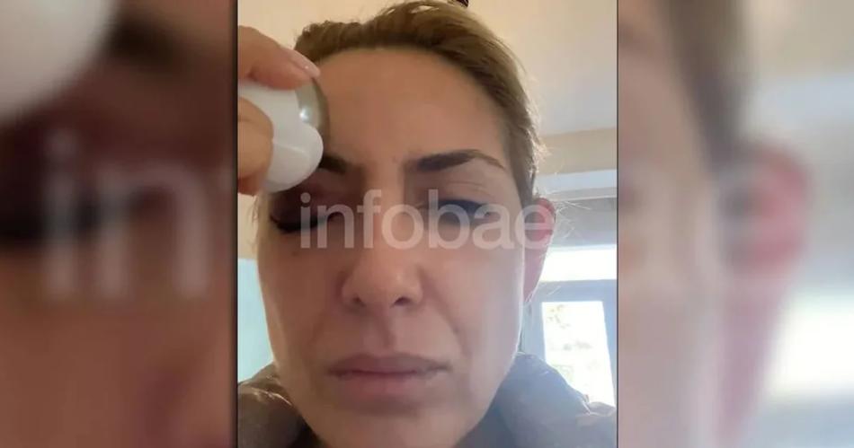 VIDEO  Filtran imaacutegenes de Fabiola Yantildeez curaacutendose un ojo morado