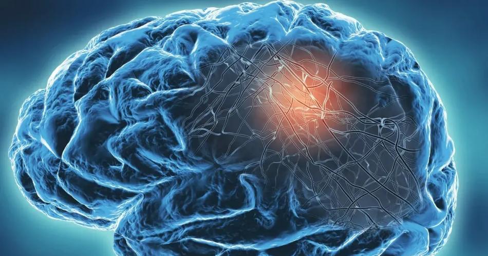 Un estudio revela que pacientes que tuvieron Covid-19 grave envejecen su cerebro unos 20 antildeos