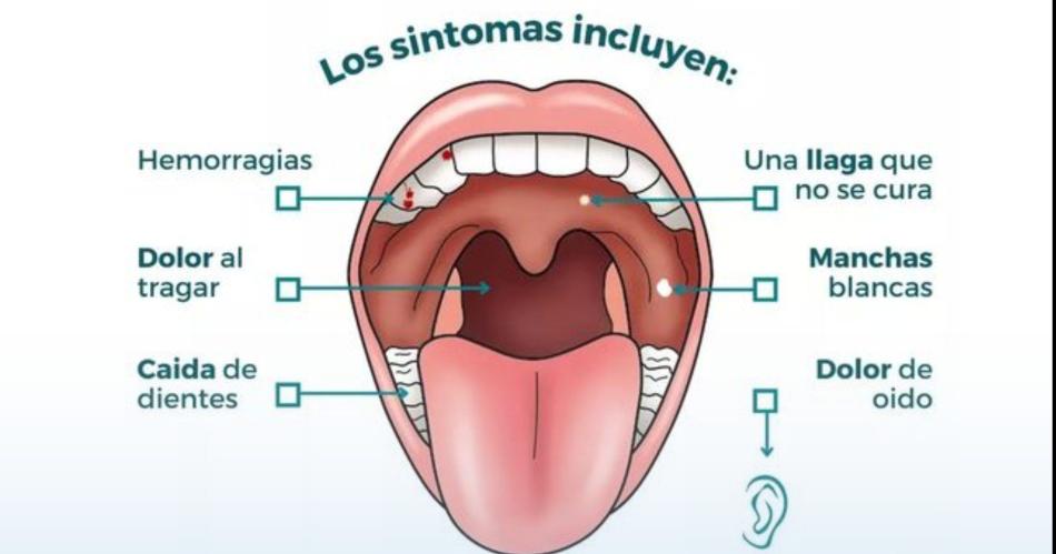 Alertan que el consumo de tabaco y alcohol potencia las chances de sufrir caacutencer bucal