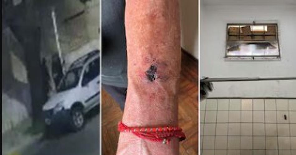 Una anciana sufrioacute un brutal robo- la despertaron a golpes y la maniataron para pedirle dinero