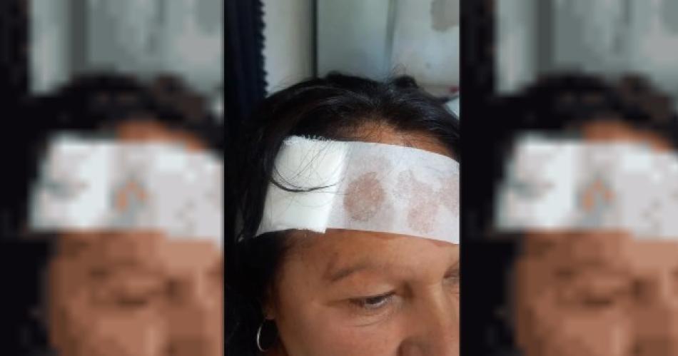 Mujer fue golpeada brutalmente en la cabeza por delincuentes