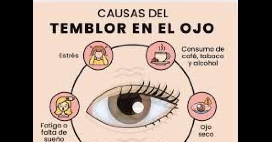 Espasmos oculares- iquestqueacute son y por queacute se producen